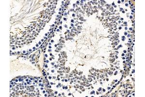 ABIN7096647 and ABIN7100712 at 1/100 staining rat testis tissue by IHC-P. (RAX 抗体)