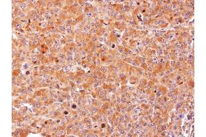 IHC-P Image Immunohistochemical analysis of paraffin-embedded H1299 xenograft, using AdoHcyase, antibody at 1:100 dilution. (AHCY 抗体)