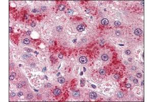 Human Liver (formalin-fixed, paraffin-embedded) stained with LEPRat 4 µg/ml followed by biotinylated anti-goat IgG secondary antibody, alkaline phosphatase-streptavidin and chromogen. (Leptin Receptor 抗体  (Internal Region))