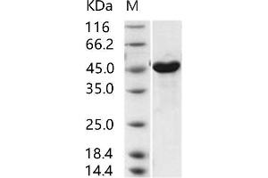 MERS-Coronavirus Nucleocapsid Protein (MERS-CoV N) protein (His tag)