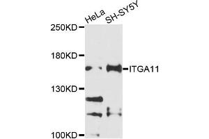 Western blot analysis of extracts of HeLa and SH-SY5Y cells, using ITGA11 antibody. (ITGA11 抗体)