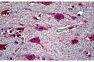 Immunohistochemistry (IHC) image for anti-EH-Domain Containing 1 (EHD1) (N-Term) antibody (ABIN7013871)