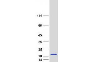 Western Blotting (WB) image for Hemoglobin, zeta (HBZ) protein (Myc-DYKDDDDK Tag) (ABIN2722458)