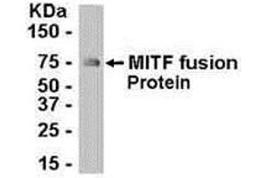 Western Blotting (WB) image for anti-Microphthalmia-Associated Transcription Factor (MITF) (AA 287-417) antibody (ABIN2467990) (MITF 抗体  (AA 287-417))
