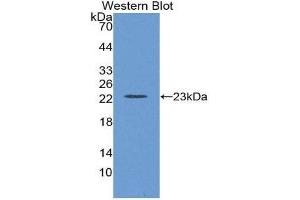 Western Blotting (WB) image for anti-Lectin, Galactoside-Binding, Soluble, 8 (LGALS8) (AA 151-316) antibody (ABIN1862521) (LGALS8 抗体  (AA 151-316))