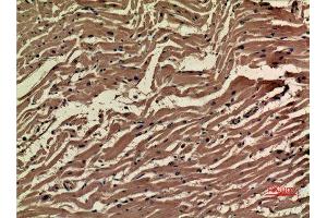 Immunohistochemistry (IHC) analysis of paraffin-embedded Human Heart, antibody was diluted at 1:100.