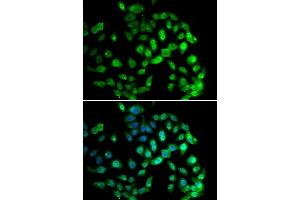 Immunofluorescence analysis of U2OS cells using GPS1 antibody. (GPS1 抗体)
