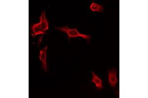 ABIN6274461 staining HepG2 by IF/ICC. (MAP4K1 抗体  (Internal Region))