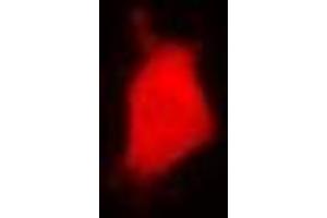 Immunofluorescent analysis of PARN staining in U2OS cells. (PARN 抗体)