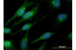Immunofluorescence of monoclonal antibody to CTNNB1 on HeLa cell. (CTNNB1 抗体  (AA 682-781))