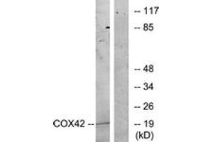 Western blot analysis of extracts from K562 cells, treated with insulin 0. (COX4I2 抗体  (AA 31-80))