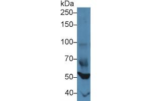 Western blot analysis of Mouse Heart lysate, using Mouse FOXP1 Antibody (3 µg/ml) and HRP-conjugated Goat Anti-Rabbit antibody ( (FOXP1 抗体  (AA 122-346))