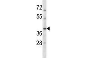 RAD51C antibody western blot analysis in HepG2 lysate. (RAD51C 抗体  (AA 169-198))
