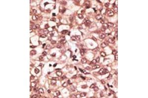 Image no. 2 for anti-Toll-Like Receptor 6 (TLR6) (C-Term) antibody (ABIN357053) (TLR6 抗体  (C-Term))