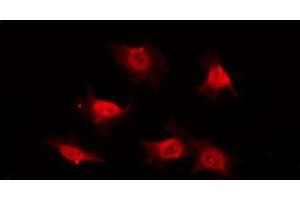 ABIN6269202 staining COS7 by IF/ICC. (PI3K p85 alpha/gamma 抗体)