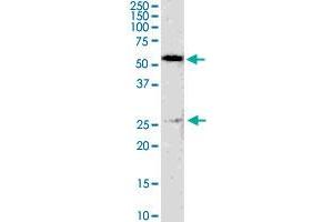 GSTM4 monoclonal antibody (M01), clone 4B4. (GSTM4 抗体  (AA 23-119))