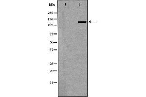 Western blot analysis of extracts of placenta, using NOS3 antibody. (ENOS 抗体  (Internal Region))