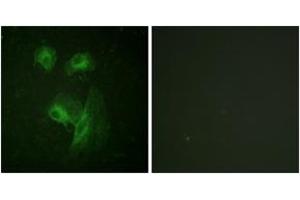 Immunofluorescence (IF) image for anti-Ribosomal Protein S6 Kinase, 70kDa, Polypeptide 1 (RPS6KB1) (AA 195-244) antibody (ABIN2888683) (RPS6KB1 抗体  (AA 195-244))