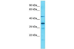 Host: Rabbit Target Name: IST1 Sample Type: COLO205 Whole Cell lysates Antibody Dilution: 1. (IST1 抗体  (C-Term))