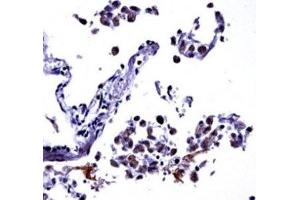 IL-13 antibody immunohistochemistry analysis in formalin fixed and paraffin embedded human lung tissue. (IL-13 抗体  (AA 118-146))