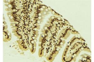 ABIN6266588 at 1/100 staining Mouse colon tissue by IHC-P. (MDM2 抗体)