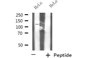 Western blot analysis of extracts from HeLa cells, using KCNH3 antibody. (KCNH3 抗体  (C-Term))