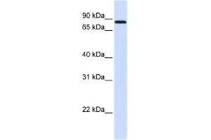 MAP4K2 antibody used at 1 ug/ml to detect target protein. (MAP4K2 抗体  (N-Term))