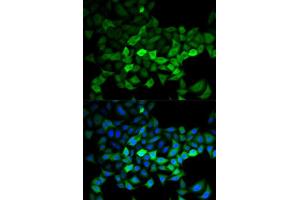 Immunofluorescence analysis of HeLa cells using UBE2C antibody (ABIN5973207). (UBE2C 抗体)