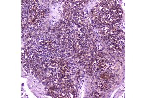 IHC analysis of PLCG 2 using anti-PLCG 2 antibody . (Phospholipase C gamma 2 抗体  (AA 1201-1258))