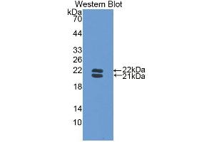 Western blot analysis of the recombinant protein. (Haptoglobin 抗体  (AA 118-281))