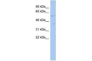 WB Suggested Anti-SMYD2 Antibody Titration:  0. (SMYD2A 抗体  (Middle Region))