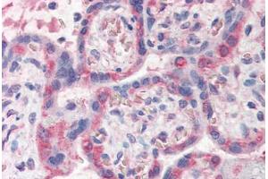 Human Placenta (formalin-fixed, paraffin-embedded) stained with PDLIM1 antibody ABIN337145 at 5 ug/ml followed by biotinylated anti-goat IgG secondary antibody ABIN481715, alkaline phosphatase-streptavidin and chromogen. (PDLIM1 抗体  (AA 316-329))