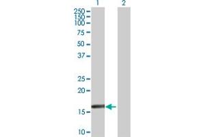 Western Blot analysis of RARRES3 expression in transfected 293T cell line by RARRES3 MaxPab polyclonal antibody. (RARRES3 抗体  (AA 1-164))