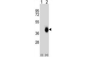 Western blot analysis of FCAR (arrow) using rabbit polyclonal FCAR Antibody (Center) . (FCAR 抗体  (Middle Region))