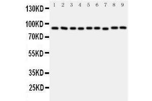 Western Blotting (WB) image for anti-Valosin Containing Protein (VCP) (AA 749-766), (C-Term) antibody (ABIN3043984) (VCP 抗体  (C-Term))