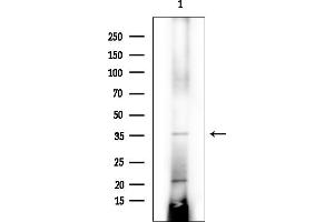 Western blot analysis of lysates from COLO205 cells(heat-shock treatment), using AASDHPPT Antibody at 1/1000 dilution.