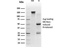 SDS-PAGE Analysis Purified 58K Golgi Protein Mouse Monoclonal (FTCD/357). (FTCD 抗体)