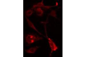 Immunofluorescence (fixed cells) (IF/ICC) image for anti-Ral GTPase Activating Protein, alpha Subunit 2 (Catalytic) (RALGAPA2) (Internal Region) antibody (ABIN6258501)
