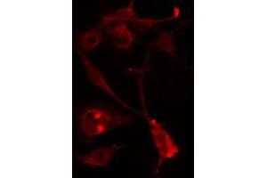 ABIN6274590 staining Hela cells by IF/ICC. (RALGAPA2 抗体  (Internal Region))