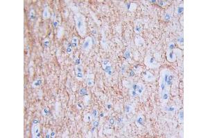 Used in DAB staining on fromalin fixed paraffin- embedded Kidney tissue (PUS1 抗体  (AA 1-427))