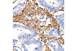 Immunohistochemistry (IHC) image for anti-Vimentin (VIM) antibody (ABIN7271326)