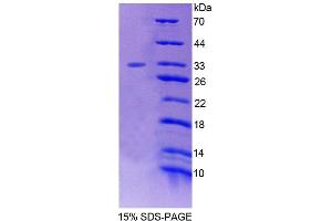 SDS-PAGE analysis of Human FOXO3 Protein. (FOXO3 蛋白)
