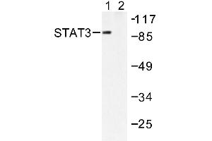Image no. 1 for anti-Signal Transducer and Activator of Transcription 3 (Acute-Phase Response Factor) (STAT3) antibody (ABIN271827) (STAT3 抗体)