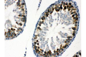 Immunohistochemistry (IHC) image for anti-Y Box Binding Protein 1 (YBX1) (AA 293-320), (C-Term) antibody (ABIN3043966)