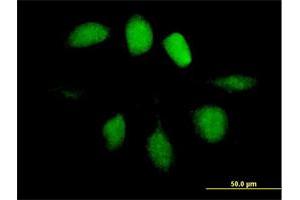 Immunofluorescence of purified MaxPab antibody to UBL4A on HeLa cell. (UBL4A 抗体  (AA 1-157))
