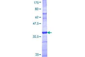 ARL6IP5 Protein (AA 1-64) (GST tag)