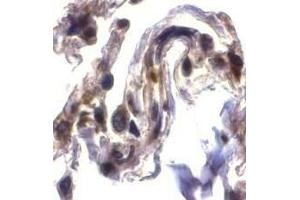 Immunohistochemical staining of ARTS in human lung tissue with ARTS antibody at 2μg/ml. (Septin 4 抗体  (N-Term))