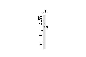 C9orf72 Antibody (C-term) (ABIN656852 and ABIN2846057) western blot analysis in WiDr cell lysate (35 μg/lane). (C9ORF72 抗体  (C-Term))