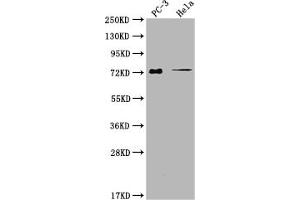 Western Blot Positive WB detected in: PC-3 whole cell lysate, Hela whole cell lysate All lanes: GLB1L3 antibody at 1:2000 Secondary Goat polyclonal to rabbit IgG at 1/50000 dilution Predicted band size: 75, 36 kDa Observed band size: 75 kDa (GLB1L3 抗体  (AA 1-236))
