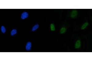 IF analysis of SLU7 using anti-SLU7 antibody (ABIN7601697).
